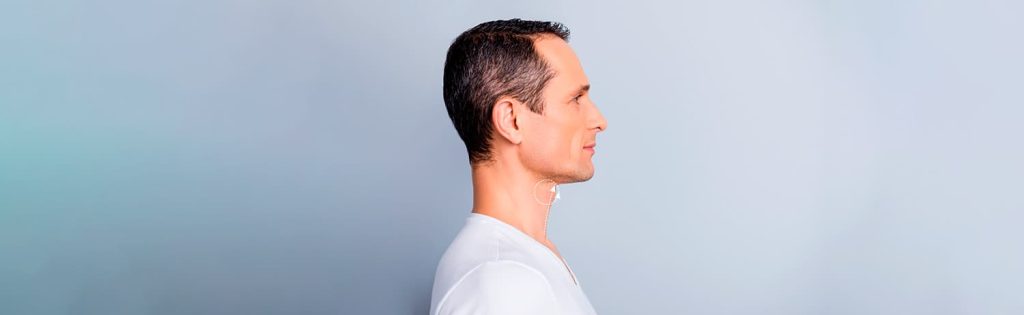 Masculinización Facial